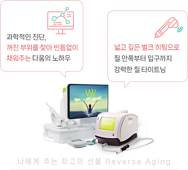 비비브 viveve